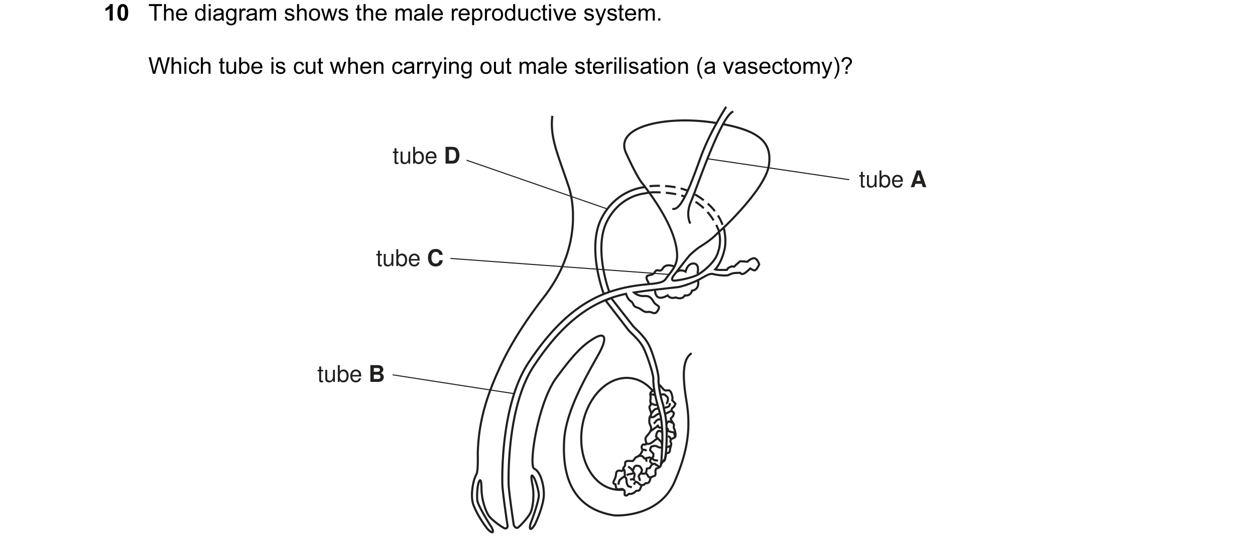 Question 6: The diagram shows the male reproductive system. Which tube is cut when carrying out male sterilisation (a vasectomy)? tube D tube A tube C …